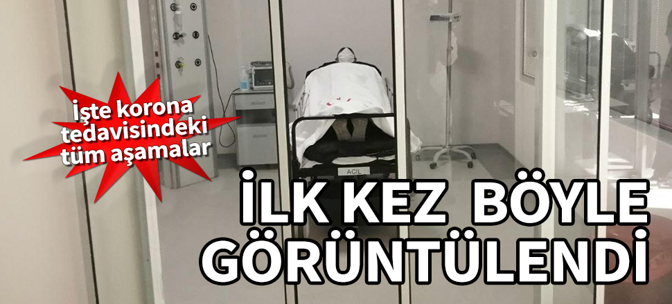 İşte korona tedavisindeki tüm aşamalar! İlk kez böyle görüntülendi