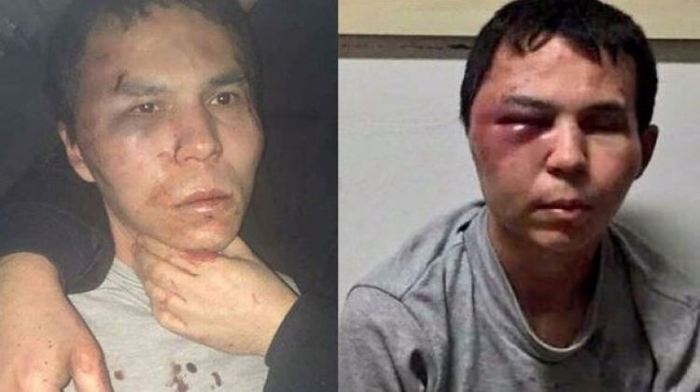 Reina'ya ölmeye gittim ancak son anda...