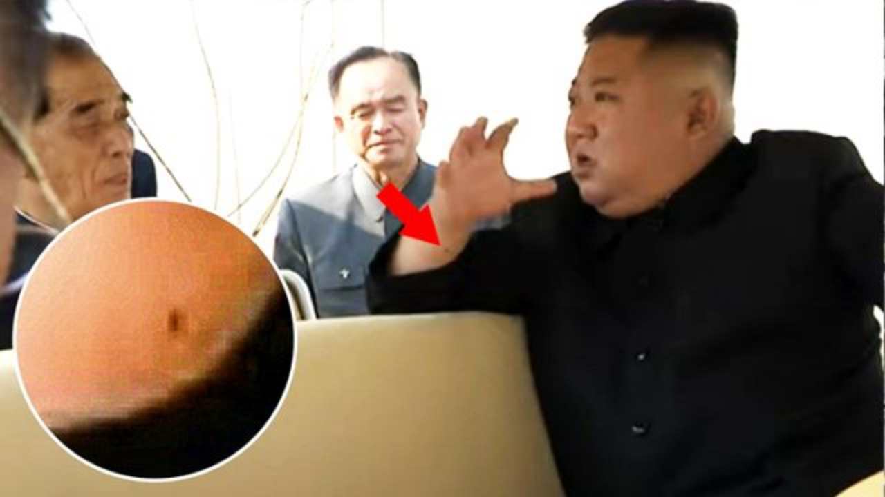 Kim'in bileğinde dikkat çeken yara detayı