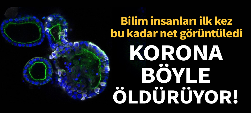 Koronavirüsün detaylı ve yüksek çözünürlüklü görüntüleri ilk kez yayımlandı