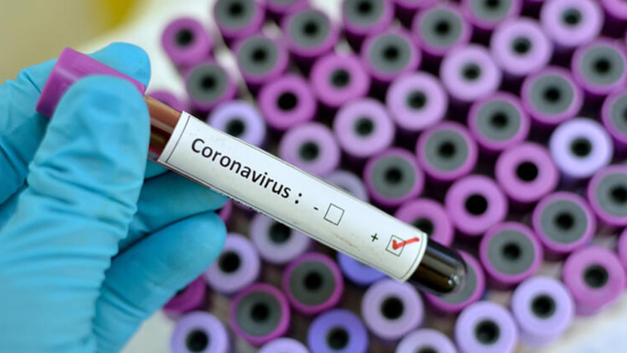 Koronavirüs sonrası büyük çöküş! Dünya devi batıyor