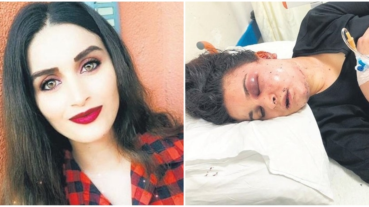 Boşanmak istediği kocası ve ailesi saatlerce işkence etti!