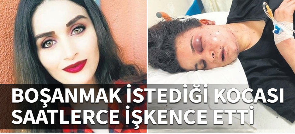 Boşanmak istediği kocası ve ailesi saatlerce işkence etti!