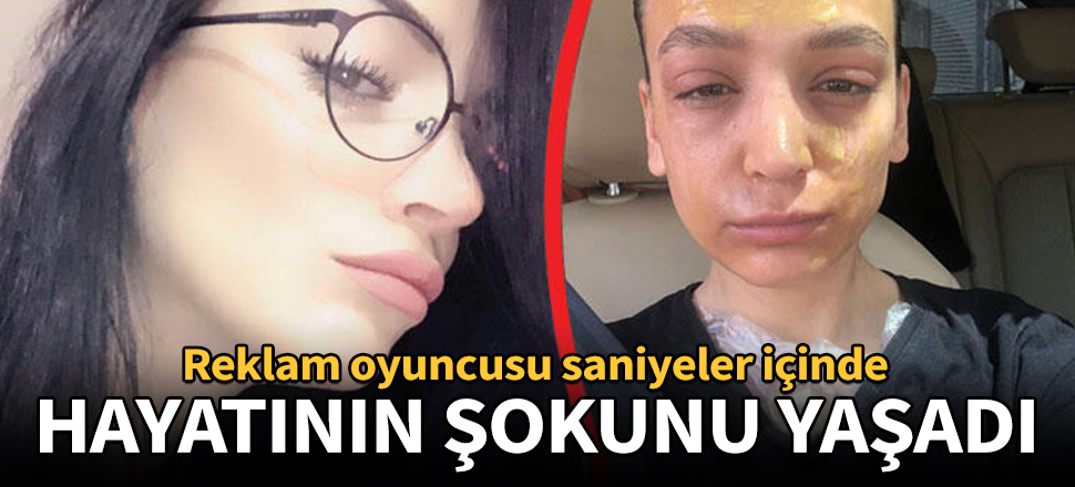Lavabo açıcı, reklam oyuncusunun yüzünde patladı!