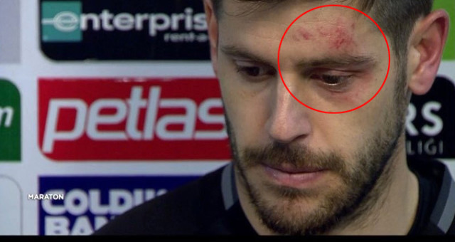 Fabri maçtan bu morluklarla çıktı!