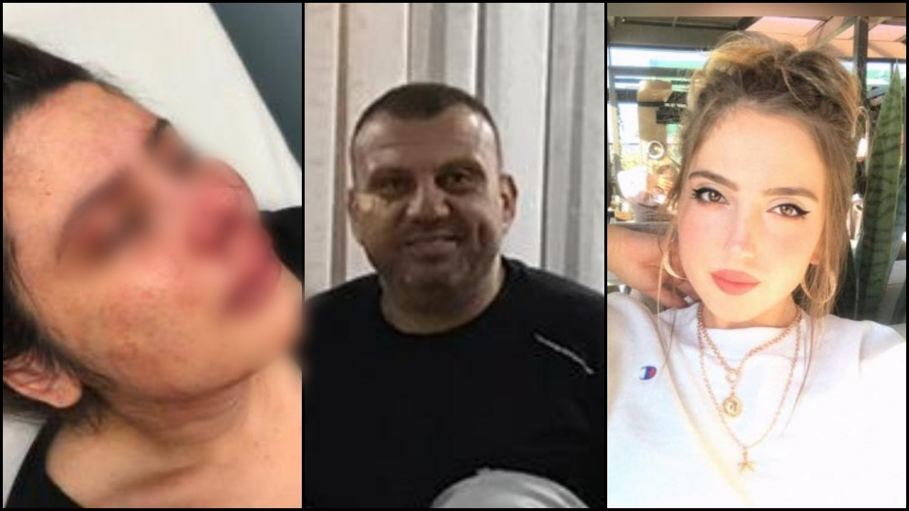 'Annemden önce beni dövmek istedi'