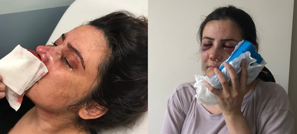 Son dakika... Eşinin kabusu yaşattığı kadın: Silah 2 defa tutukluk yaptı