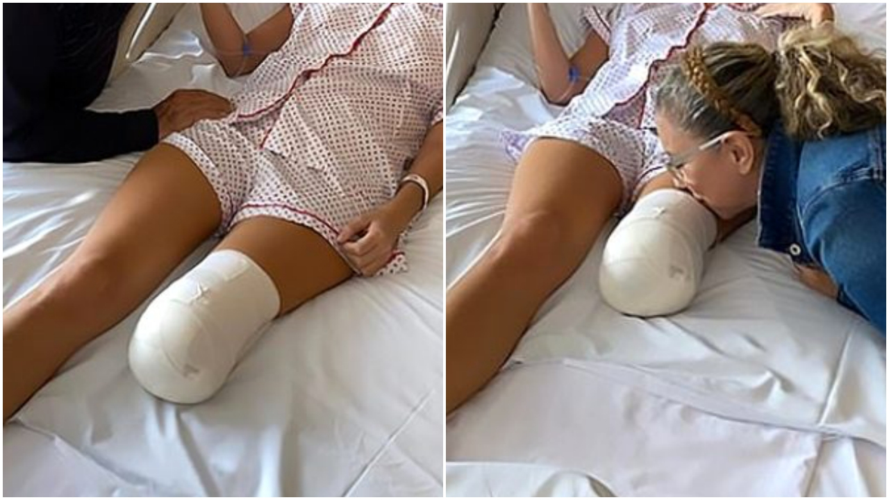 Güzel model bacağından oldu!