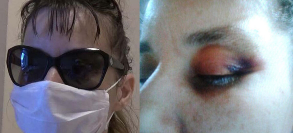 Doktor ağabeyin dayağı adliyede bitti
