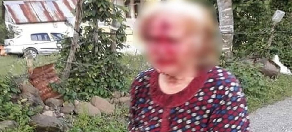 Baltayla yengesinin başına vurmuştu