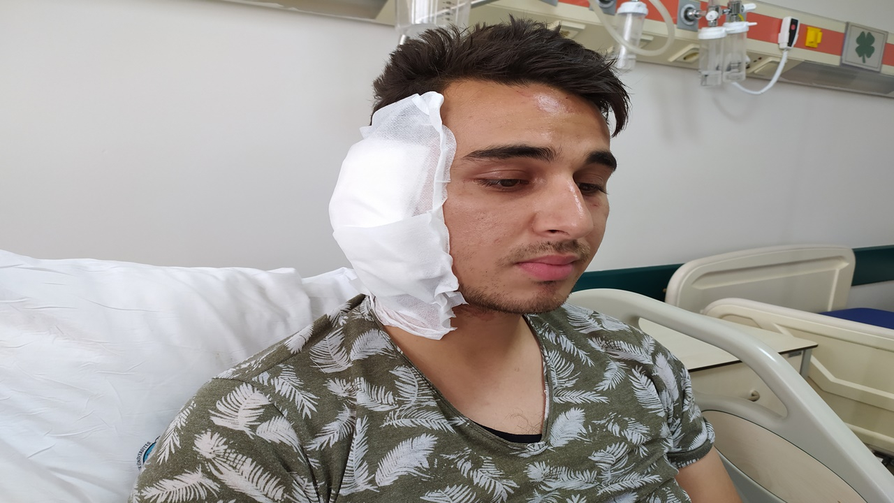 Isırılan kulağı yerine dikilemedi
