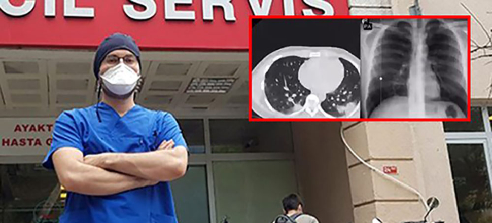 Gençleri tomografisiyle uyardı