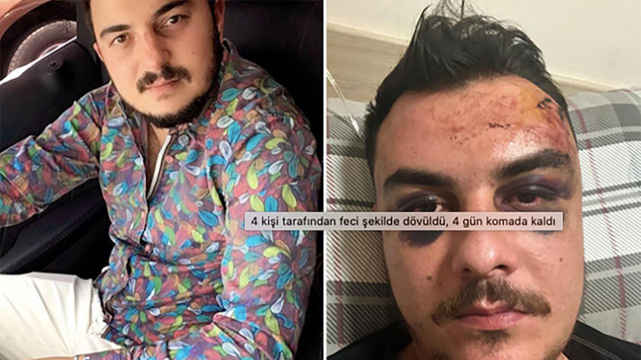Feci şekilde dövüldü! Günlerce yaşam mücadelesi verdi