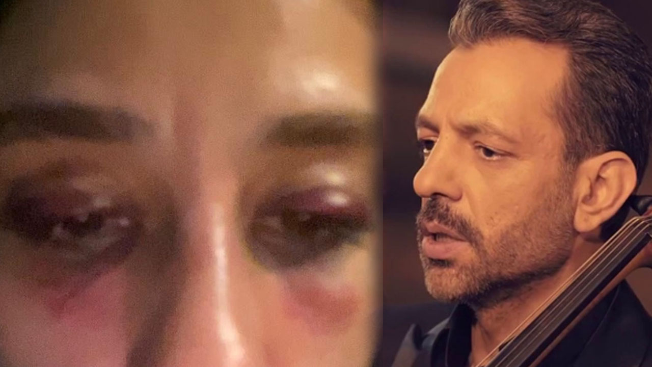 Özer Arkun'un darp ettiği genç kızın avukatından flaş 'ağır suç' açıklaması