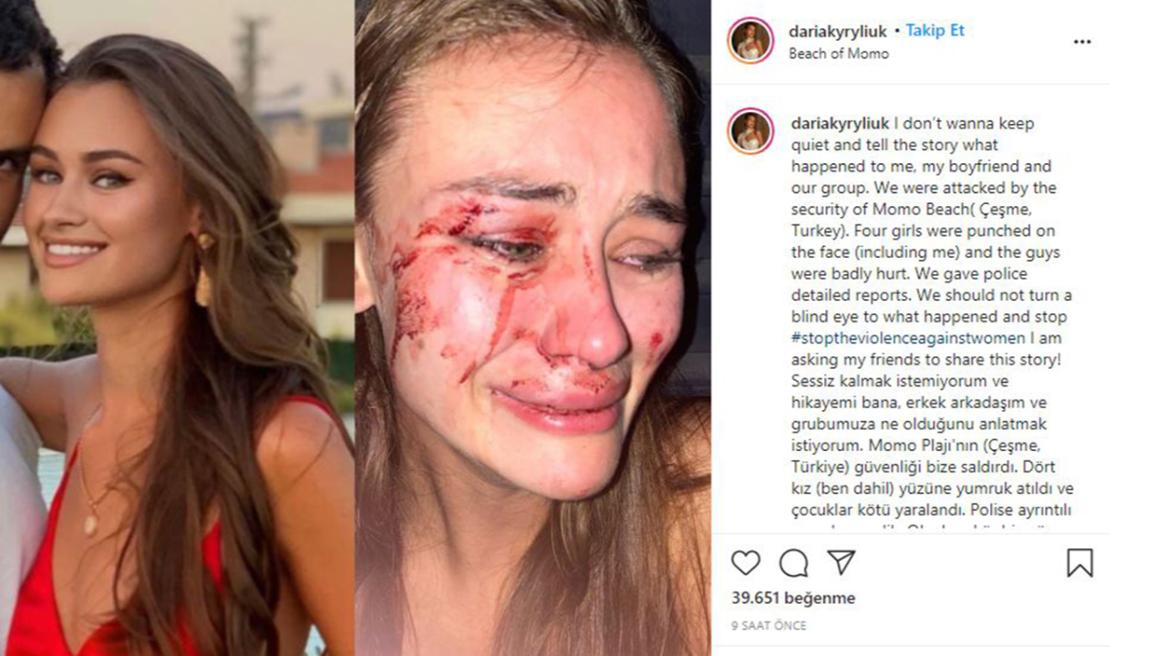 Ukraynalı top model Daria Kyryliuk'e plajda korkunç saldırı!