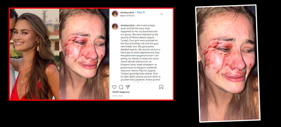 Ukraynalı top model Daria Kyryliuk'e plajda korkunç saldırı!