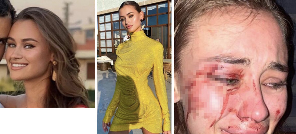 Görgü tanığı ifadesi ortaya çıktı: Karşı evden bağırtılar duydum