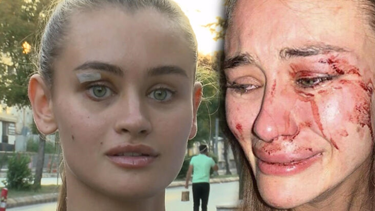 'Bir daha modellik yapamayacağım zannettim'