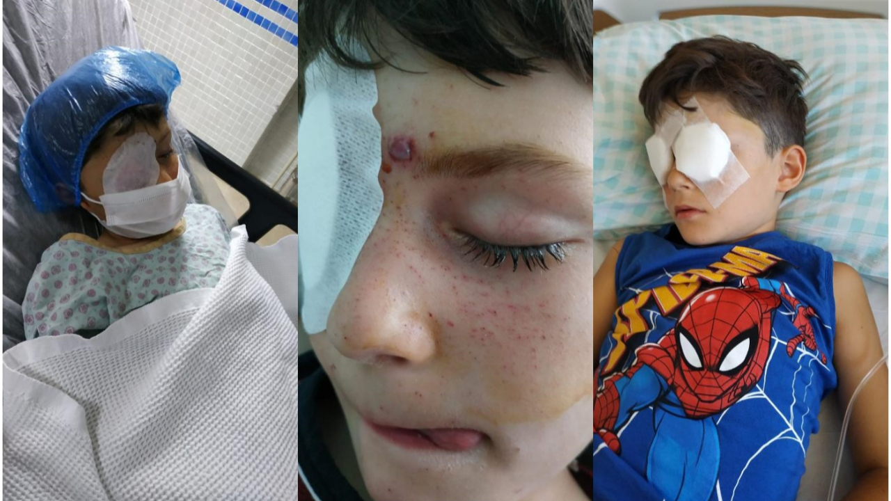Minik İhsan Arda, torpil patlamasıyla görme yetisini kaybetti