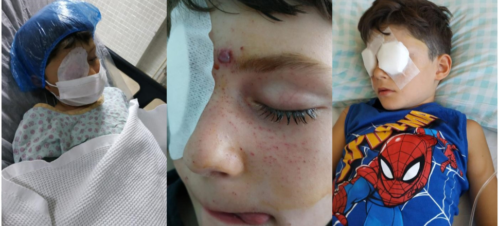 Minik İhsan Arda, torpil patlamasıyla görme yetisini kaybetti