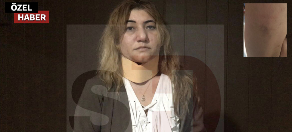 Bu mu CHP’nin özgür basın anlayışı