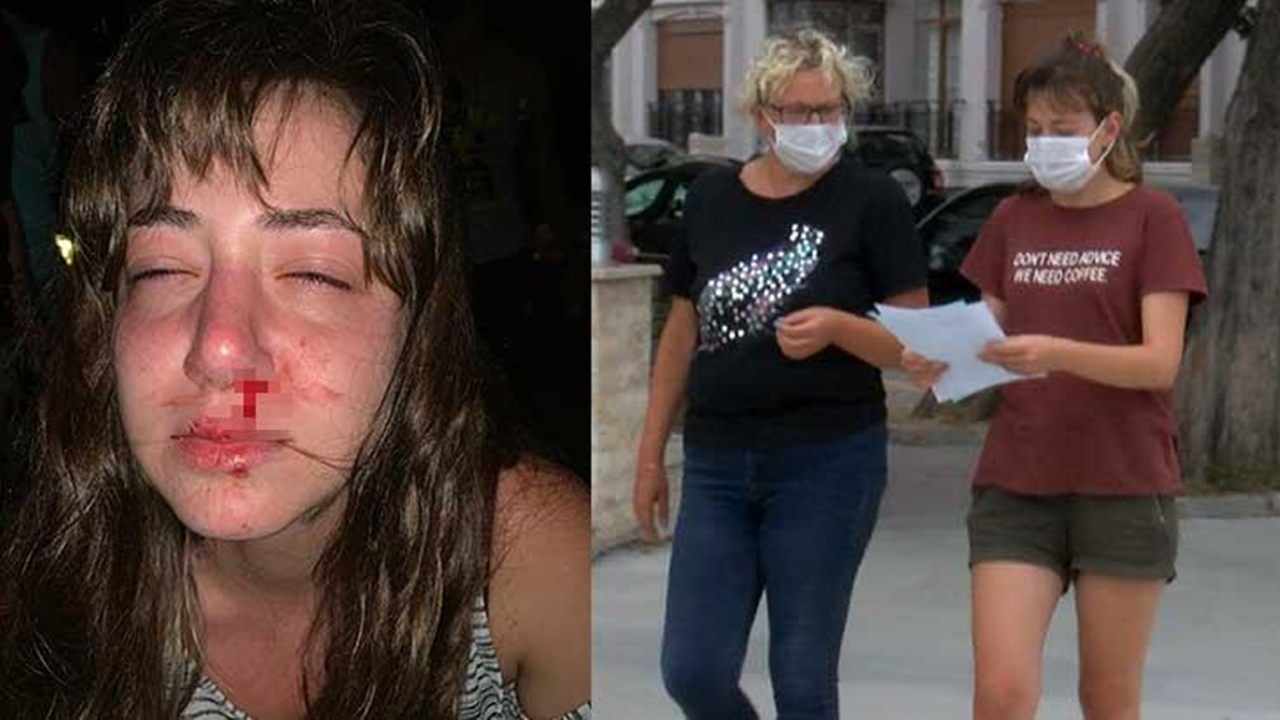 'Yüzüme yumruk attı, burnum kırıldı'
