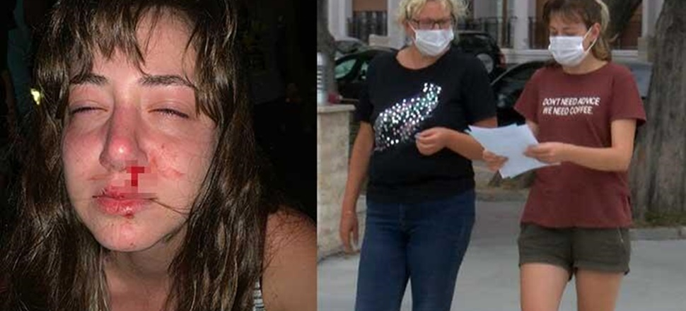 'Yüzüme yumruk attı, burnum kırıldı'