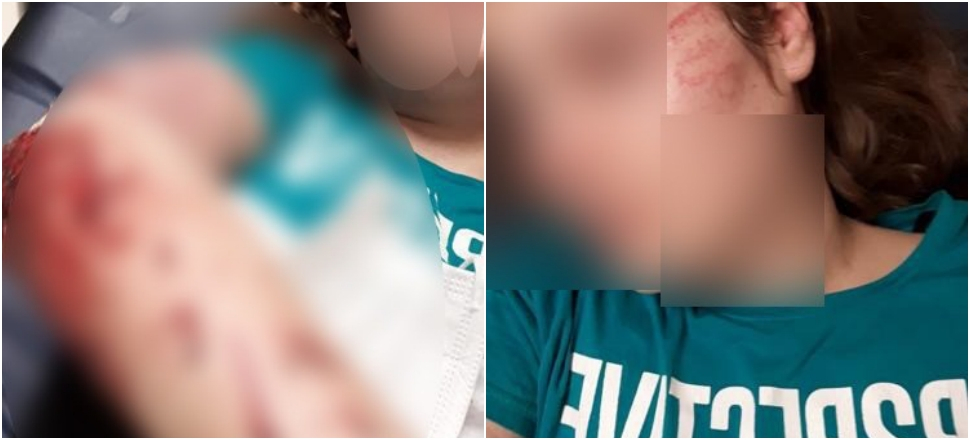 Ağabeyinden kaçarken pencereden atladı