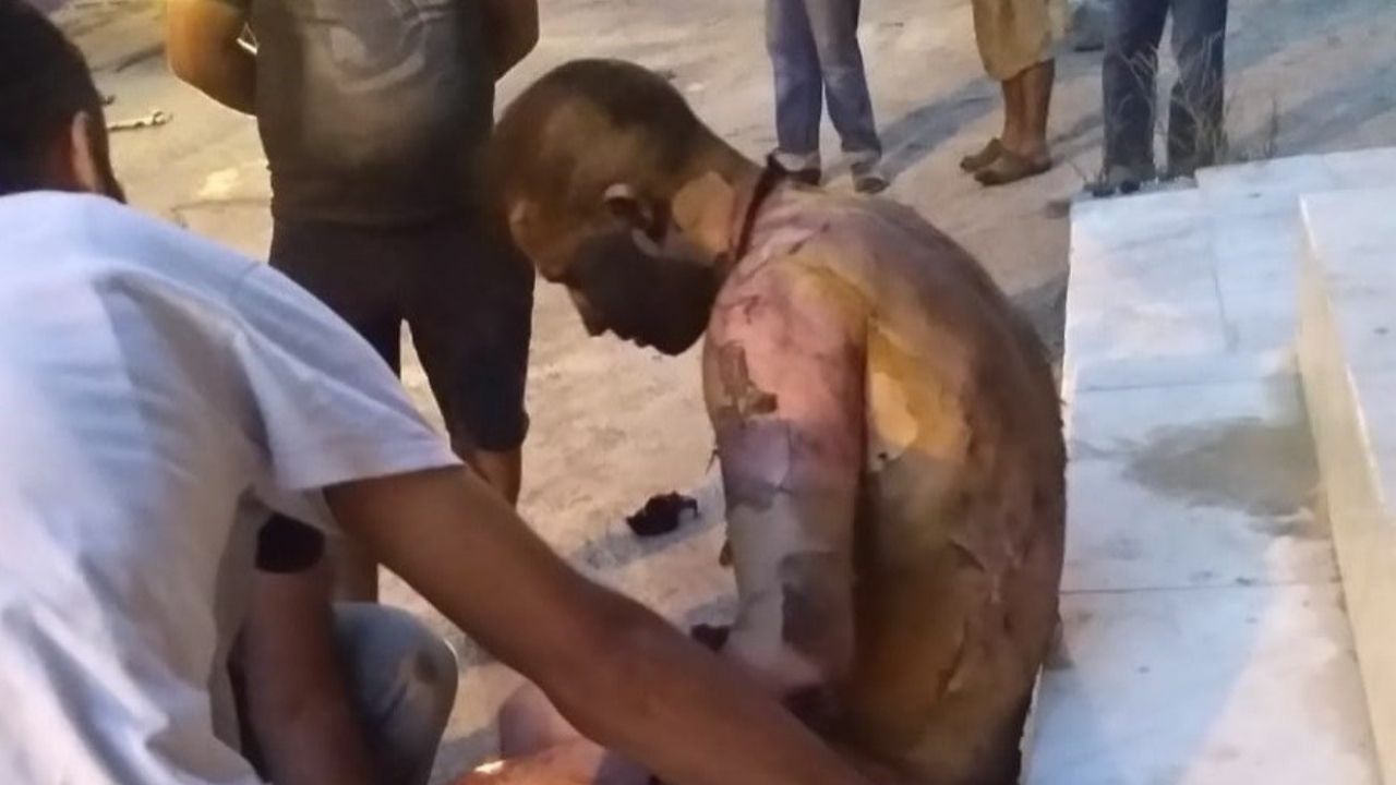Tartıştıkları adamı ateşe verdiler!
