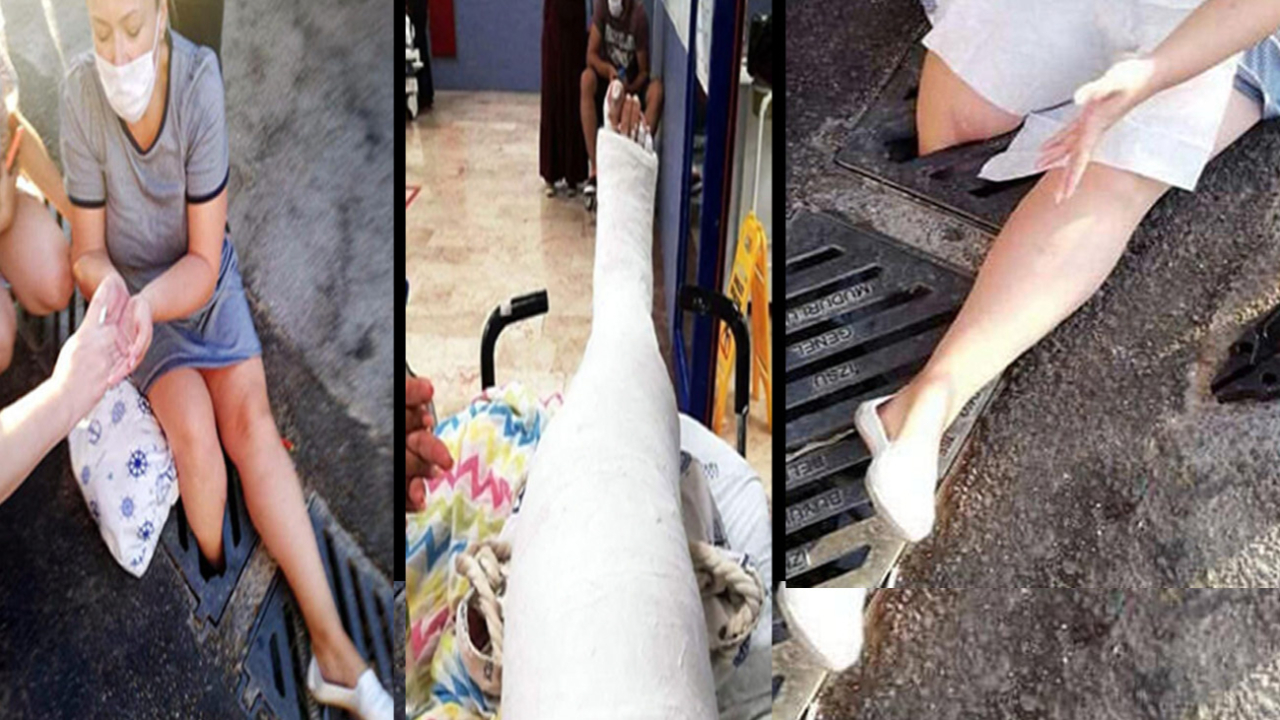 Mazgal kapağındaki kırık nedeniyle bacağı kırıldı!