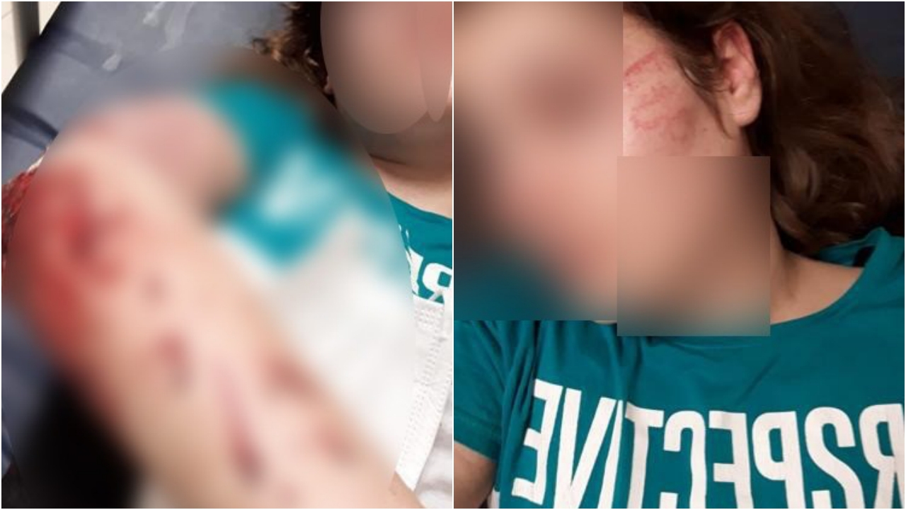 Abisinden kaçıp ikinci kattan atladı