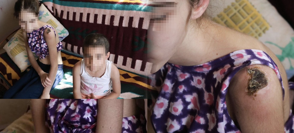 Foça'da iki kardeşe keser sapıyla şiddet iddiasında üvey baba tutuklandı