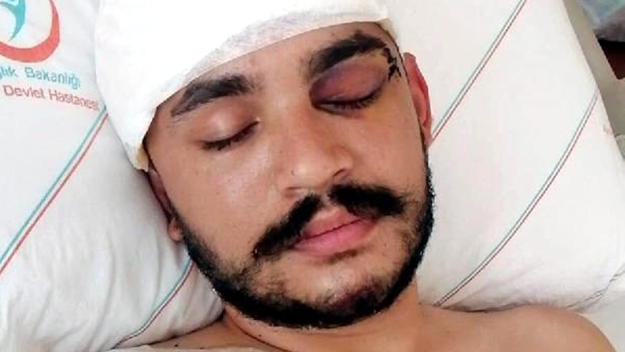 Kale direği üzerine düştü, ölümden döndü