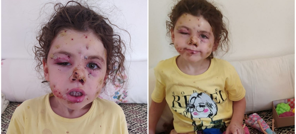 Orman yangını Hatay'a sıçradı