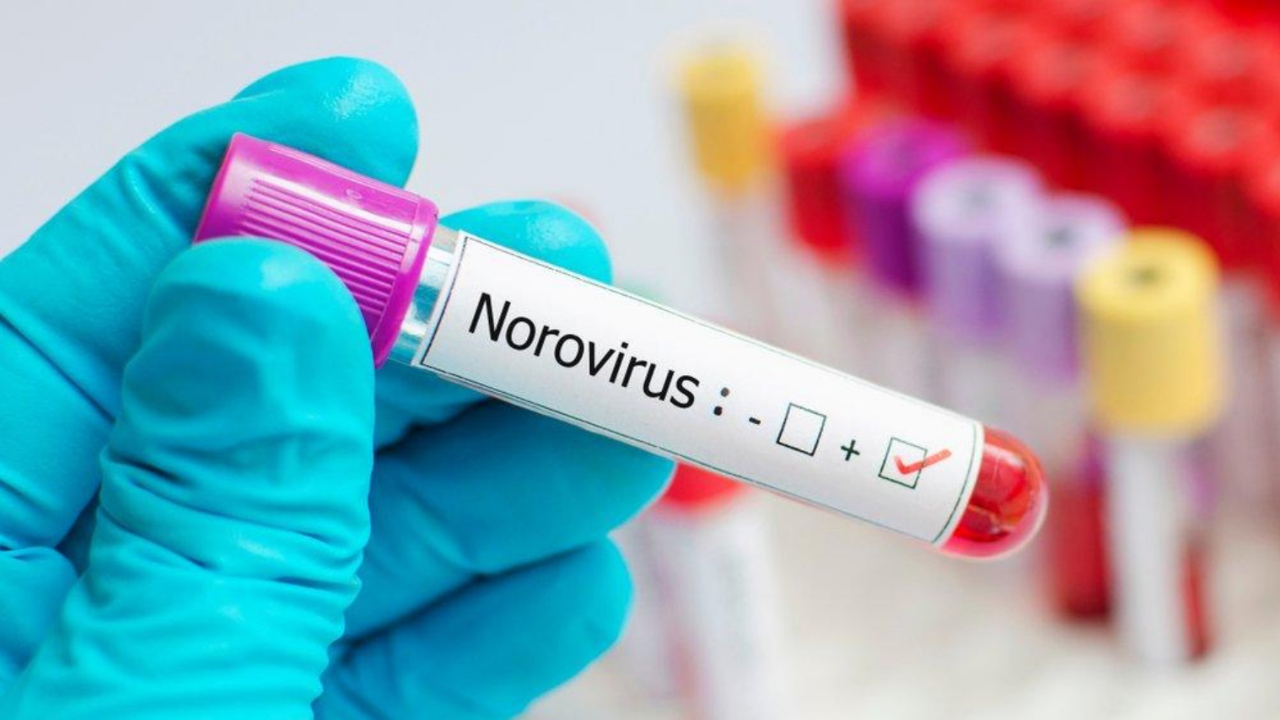 Norovirüs enfeksiyonu dolaşımda
