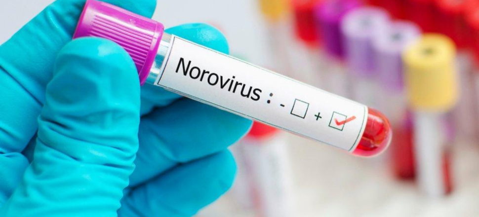 Norovirüs enfeksiyonu dolaşımda