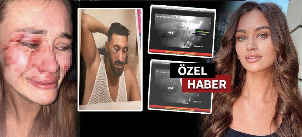 Ukraynalı manken Daria ile beraber 5 kişi daha darp edilmiş!