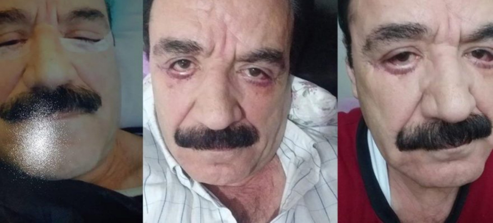 'Göz kapaklarımı kestiğini gördüm!'