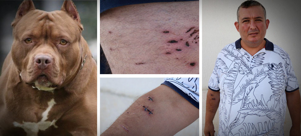 Tatile gittiği apartta köpeklerin saldırısına uğradığı iddiası