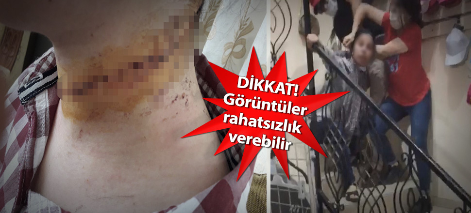 Eşinin boğazını kesti, eşarpla boğmaya çalıştı!