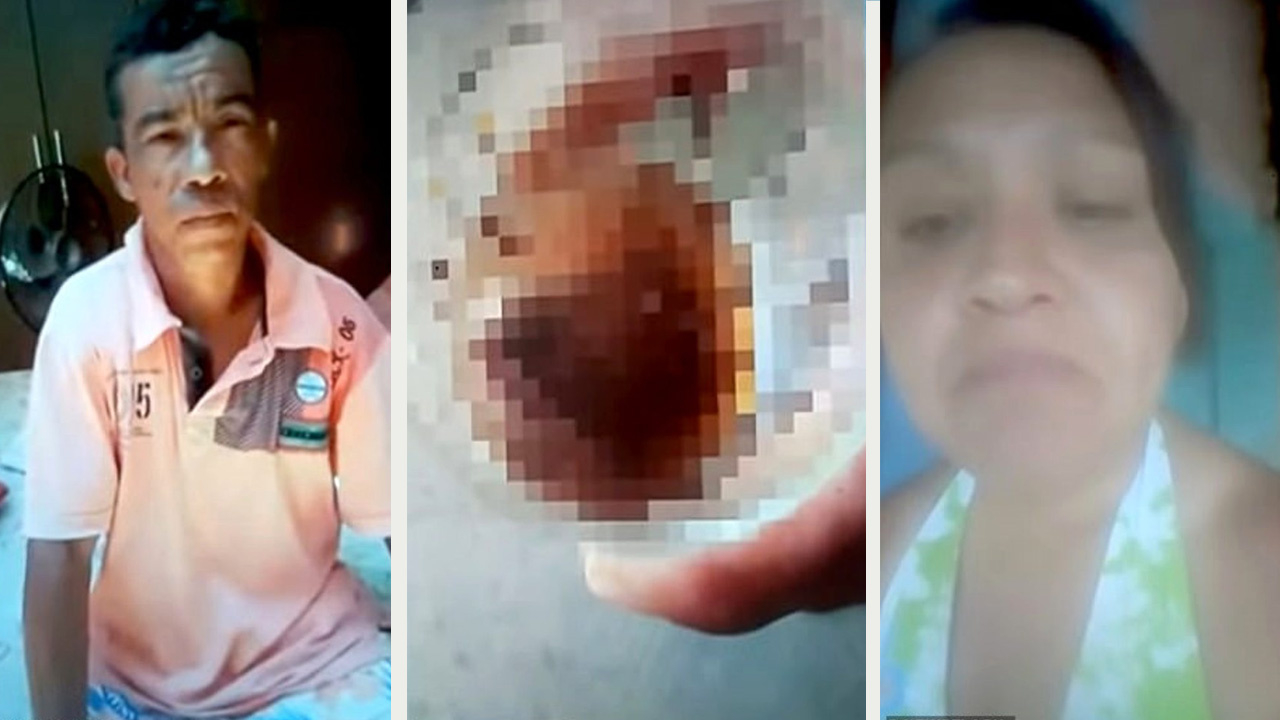 Kendisine tecavüz etmeye kalkan eski sevgilisinin cinsel organını ısırıp kopardı!
