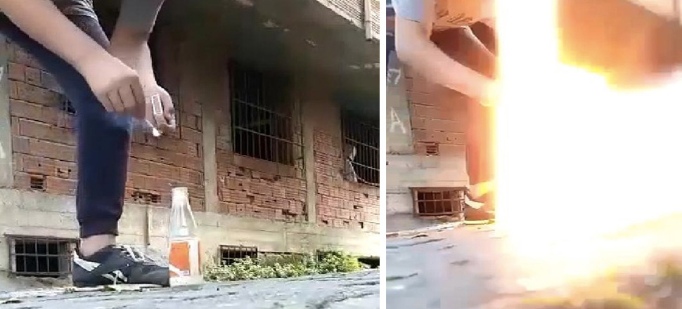 Torpil nedeniyle gözünü kaybetti! 'Tehlikeli şeylerle oynamayın'