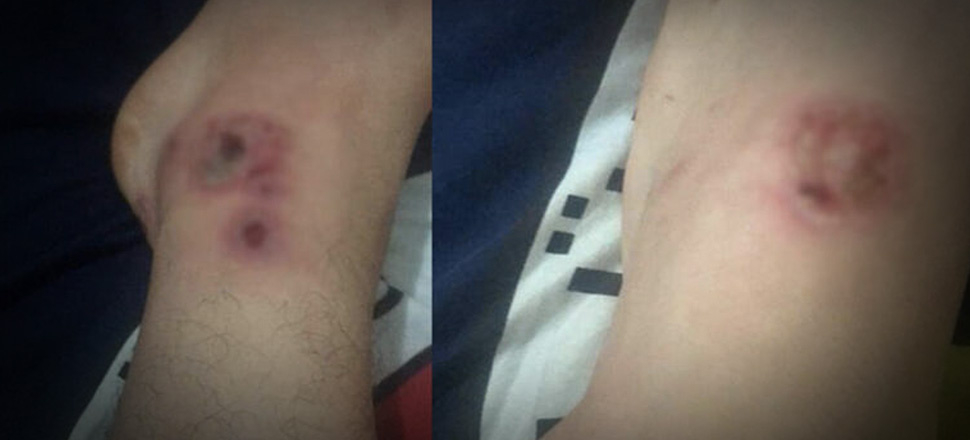 'Asya Kaplan Sivrisineği'ne karşı biyolojik mücadele çalışmaları başladı