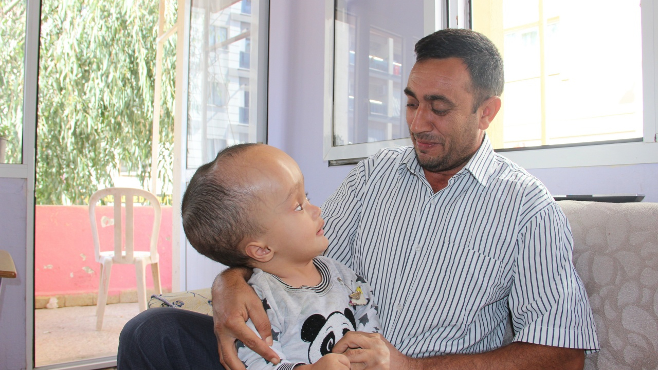 Minik Sercan'ın kafası küçülmeye başladı