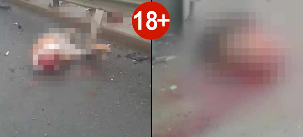 Boğazına bariyer saplandı kafası koptu