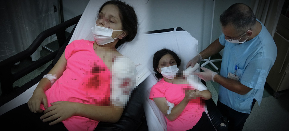 Samsun'da küçük kıza 3 pitbull saldırdı!