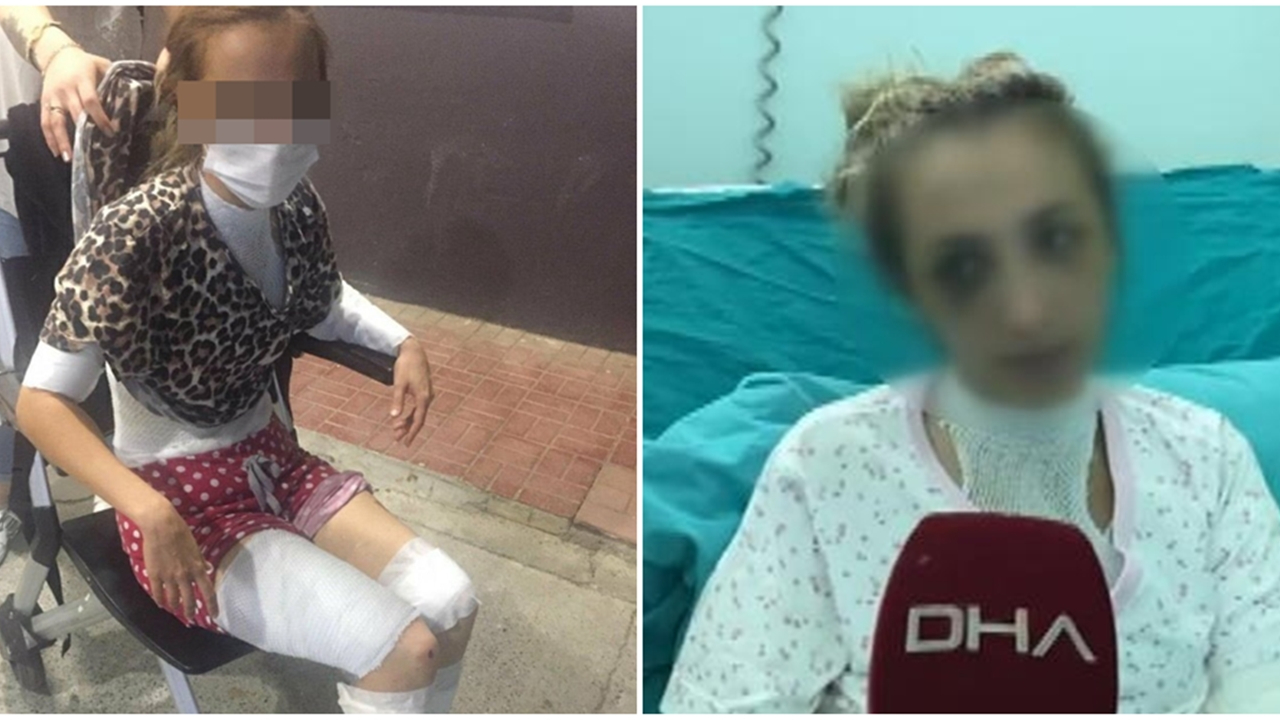Bıçağı ısıtıp eşinin vücuduna bastırdı