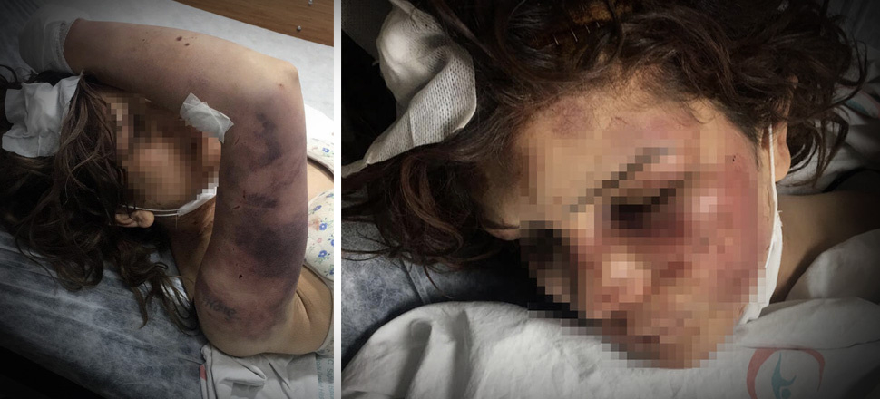 Şanlıurfa'da kan donduran olay! 3 çocuk annesine günlerce işkence yaptı