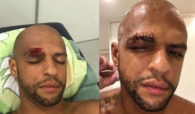 Felipe Melo yürekleri ağza getirdi