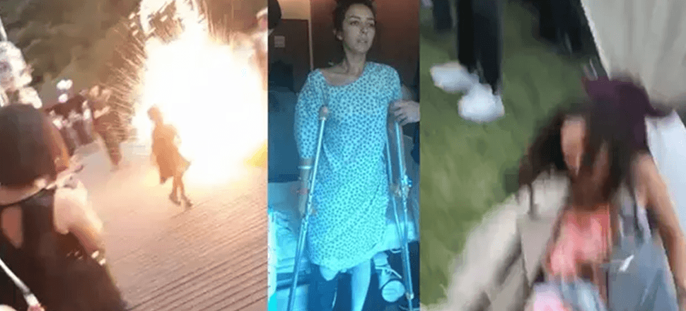 Düğünde atılan havai fişek, genç kadının hayatını kararttı